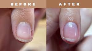 Save Your Nails This Winte